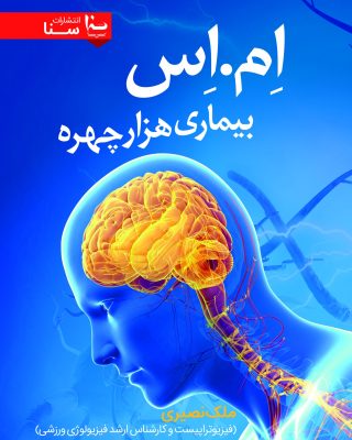 اِم.اِس بیماری هزار چهره