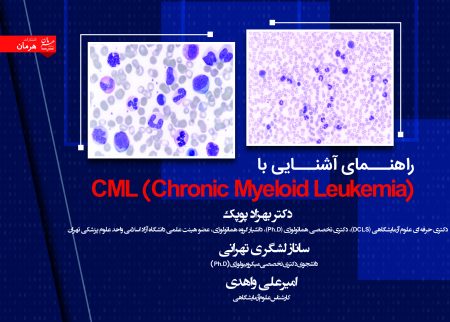 ‏‫راهنمای آشنایی با CML (Chronic Myeloid Leukemia